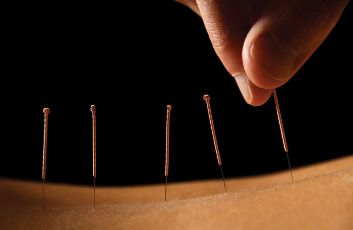 acupuncture_story